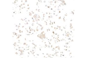 Immunocytochemistry (ICC) image for anti-Met Proto-Oncogene (MET) (C-Term) antibody (ABIN7795683)