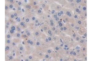 Immunohistochemistry (IHC) image for anti-Receptor Tyrosine-Protein Kinase ErbB-3 (ERBB3) (AA 707-964) antibody (ABIN7440773)