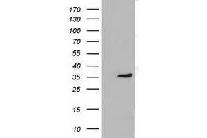 Western Blotting (WB) image for anti-Short Chain Dehydrogenase/reductase Family 9C, Member 7 (SDR9C7) antibody (ABIN1500846) (SDR9C7 antibody)