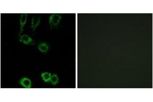 Immunofluorescence analysis of A549 cells, using CNN2 Antibody. (CNN2 antibody  (AA 121-170))