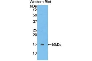 Detection of Recombinant UCP1, Rat using Polyclonal Antibody to Uncoupling Protein 1, Mitochondrial (UCP1) (UCP1 antibody  (AA 179-296))