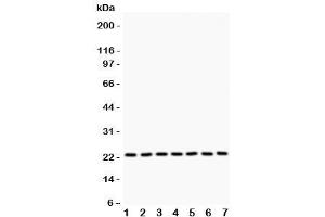 Western blot testing of GSTP1 antibody and Lane 1:  rat brain (GSTP1 antibody  (AA 2-210))