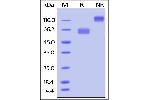 Biotinylated Human CD28, Fc Tag on SDS-PAGE under reducing (R) and no-reducing (NR) conditions. (CD28 Protein (CD28) (AA 19-152) (Fc Tag,AVI tag,Biotin))