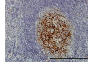 Immunoperoxidase of monoclonal antibody to SDCBP on formalin-fixed paraffin-embedded human tonsil. (SDCBP antibody  (AA 1-100))