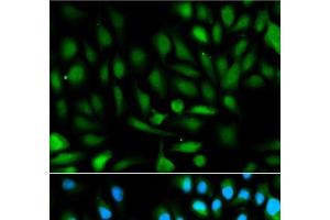Immunofluorescence analysis of HeLa cells using PARK7 Polyclonal Antibody (PARK7/DJ1 antibody)