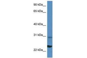 Image no. 1 for anti-Ribosomal Protein L17 (RPL17) (N-Term) antibody (ABIN6746438) (RPL17 antibody  (N-Term))