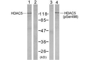 Western blot analysis of extract from NIH/3T3 cells using HDAC5 (Ab-498) antibody (E021142, Lane 1 and 2) and HDAC5 (phospho-Ser498) antibody (E011193, Lane 3 and 4). (HDAC5 antibody  (pSer498))