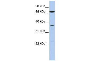 ABCB9 antibody used at 1 ug/ml to detect target protein. (ABCB9 antibody)