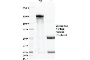 SDS-PAGE Analysis Purified CD46 Mouse Monoclonal Antibody (122. (CD46 antibody)