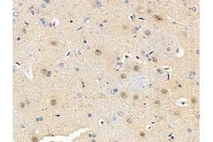 anti-Mitogen-Activated Protein Kinase Associated Protein 1 (MAPKAP1) (pThr86) antibody