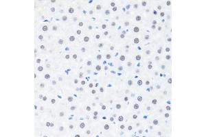 Immunohistochemistry of paraffin-embedded rat liver using BRMS1 antibody (ABIN7265929) at dilution of 1:100 (40x lens). (BRMS1 antibody  (AA 90-210))