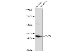 Western blot analysis of extracts of various cell lines, using (ABIN6132916, ABIN6148756, ABIN6148757 and ABIN6223050) at 1:1000 dilution.