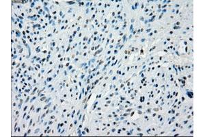 Immunohistochemical staining of paraffin-embedded colon tissue using anti-KDM4C mouse monoclonal antibody. (KDM4C antibody)