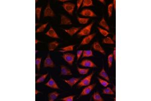 Immunofluorescence (IF) image for anti-Thioredoxin-Related Transmembrane Protein 2 (TMX2) (AA 128-296) antibody (ABIN7270810)