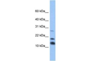 Western Blotting (WB) image for anti-C1D Nuclear Receptor Corepressor (C1D) antibody (ABIN2463345) (C1D antibody)