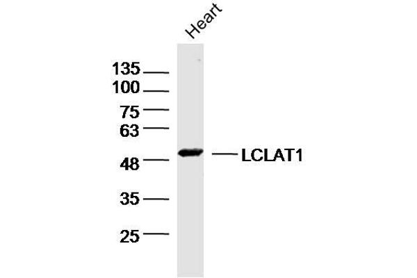 LCLAT1 抗体  (AA 261-360)