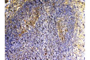 IHC analysis of VEGFB using anti-VEGFB antibody . (VEGFB antibody  (AA 22-207))