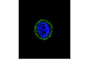 Confocal immunofluorescent analysis of CALCR Antibody (C-term) (ABIN651875 and ABIN2840433) with MCF-7 cell followed by Alexa Fluor® 488-conjugated goat anti-rabbit lgG (green). (Calcitonin Receptor antibody  (AA 465-494))