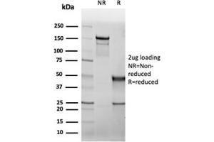 SDS-PAGE Analysis Purified CFTR Recombinant Mouse Monoclonal Antibody (rCFTR/6476). (CFTR antibody  (AA 258-385))
