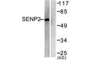 Western blot analysis of extracts from MDA-MB-435 cells, using SENP2 Antibody.