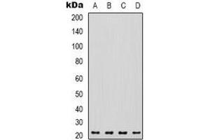 Western blot analysis of VEGFA expression in A549 (A), K562 (B), mouse liver (C), rat heart (D) whole cell lysates. (VEGFA antibody)
