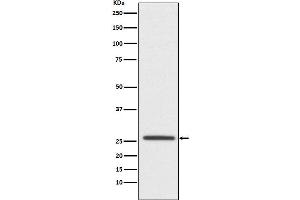 Western blot analysis of Oligodendrocyte Specific Protein expression in SH-SY5Y cell lysate.