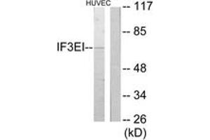 Western blot analysis of extracts from HuvEc cells, using IF3EI Antibody. (EIF3L antibody  (AA 1-50))