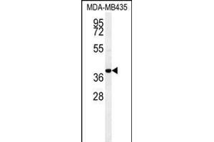 CCR8 Antibody (C-term) (ABIN654442 and ABIN2844176) western blot analysis in MDA-M cell line lysates (35 μg/lane). (CCR8 antibody  (AA 305-335))