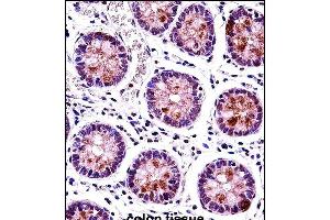 HEXIM1 Antibody (N-term) (ABIN657913 and ABIN2846861) immunohistochemistry analysis in formalin fixed and paraffin embedded human colon tissue followed by peroxidase conjugation of the secondary antibody and DAB staining. (HEXIM1 antibody  (N-Term))