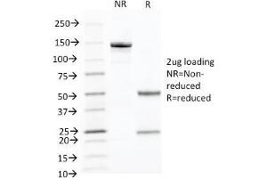 SDS-PAGE Analysis Purified Cytokeratin 10 Monoclonal Antibody (KRT10/844). (Keratin 10 antibody)