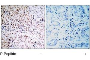 Image no. 1 for anti-Retinoblastoma 1 (RB1) (pSer795) antibody (ABIN196838) (Retinoblastoma 1 antibody  (pSer795))