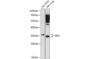 Western blot analysis of extracts of various cell lines, using SIX3 antibody (ABIN7270319) at 1:1000 dilution. (SIX3 antibody)