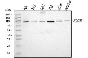 Western blot analysis of DNMT3B using anti-DNMT3B antibody (ABIN7600940).