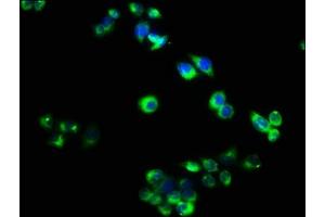 Immunofluorescence staining of PC-3 cells with ABIN7173868 at 1:40, counter-stained with DAPI. (RELT antibody  (AA 26-153))