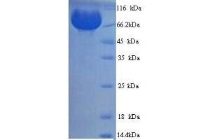 SDS-PAGE (SDS) image for Membrane Metallo-Endopeptidase (MME) (AA 52-750) protein (His tag) (ABIN5713648) (MME Protein (AA 52-750) (His tag))
