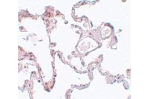 Immunohistochemistry (IHC) image for anti-Pleckstrin Homology Domain Containing, Family M (With RUN Domain) Member 1 (PLEKHM1) (N-Term) antibody (ABIN1031519) (PLEKHM1 antibody  (N-Term))