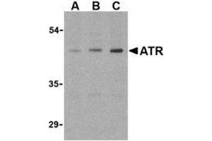 Western blot analysis of ATR in HepG2 cell lysates with this product atR antibody (IN) at (A) 0. (ANTXR1 antibody  (Intermediate Domain))