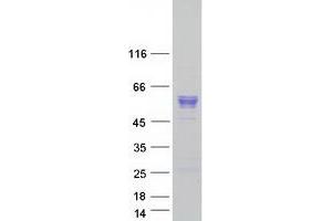 Validation with Western Blot