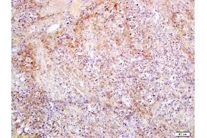 Formalin-fixed and paraffin embedded rat colon carcinoma labeled with Anti-Slc22A17 Y Polyclonal Antibody, Unconjugated  at 1:300, followed by conjugation to the secondary antibody and DAB staining (SLC22A17 antibody  (AA 475-538))