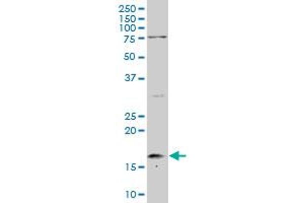 UBE2V1 antibody  (AA 1-147)