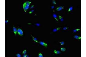 Immunofluorescence (IF) image for anti-DnaJ (Hsp40) Homolog, Subfamily C, Member 6 (DNAJC6) (AA 201-500) antibody (ABIN7166807)