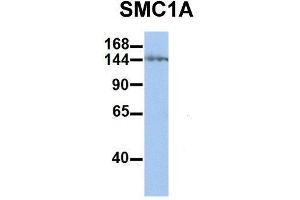 Host:  Rabbit  Target Name:  SMC1A  Sample Type:  Human Jurkat  Antibody Dilution:  1. (SMC1A antibody  (C-Term))