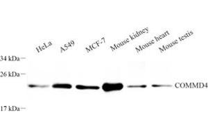 Western blot analysis of COMMD4 (ABIN7073559) at dilution of 1: 250 (COMMD4 antibody)