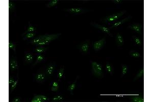 Immunofluorescence of purified MaxPab antibody to TSPYL6 on HeLa cell. (TSPY-Like 6 antibody  (AA 1-410))