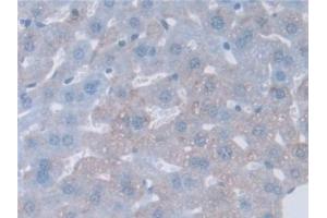 Detection of GAMT in Mouse Liver Tissue using Polyclonal Antibody to Guanidinoacetate-N-Methyltransferase (GAMT) (GAMT antibody  (AA 2-236))