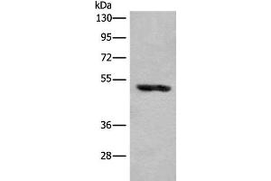 Western blot analysis of Human placenta tissue lysate using KLHDC2 Polyclonal Antibody at dilution of 1:400 (KLHDC2 antibody)