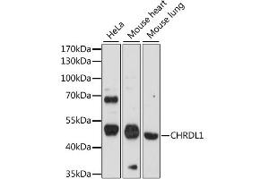 Western blot analysis of extracts of various cell lines, using CHRDL1 antibody (ABIN6292367) at 1:1000 dilution. (CHRDL1 antibody)
