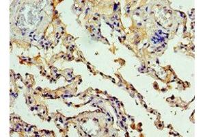 Immunohistochemistry of paraffin-embedded human lung tissue using ABIN7146811 at dilution of 1:100 (CEACAM8 antibody  (AA 35-320))