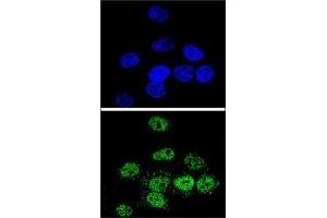 Confocal immunofluorescent analysis of MEF2A antibody with HeLa cells followed by Alexa Fluor 488-conjugated goat anti-rabbit lgG (green).