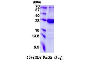 Image no. 1 for Mediator Complex Subunit 20 (MED20) protein (His tag) (ABIN1098486) (MED20 Protein (His tag))